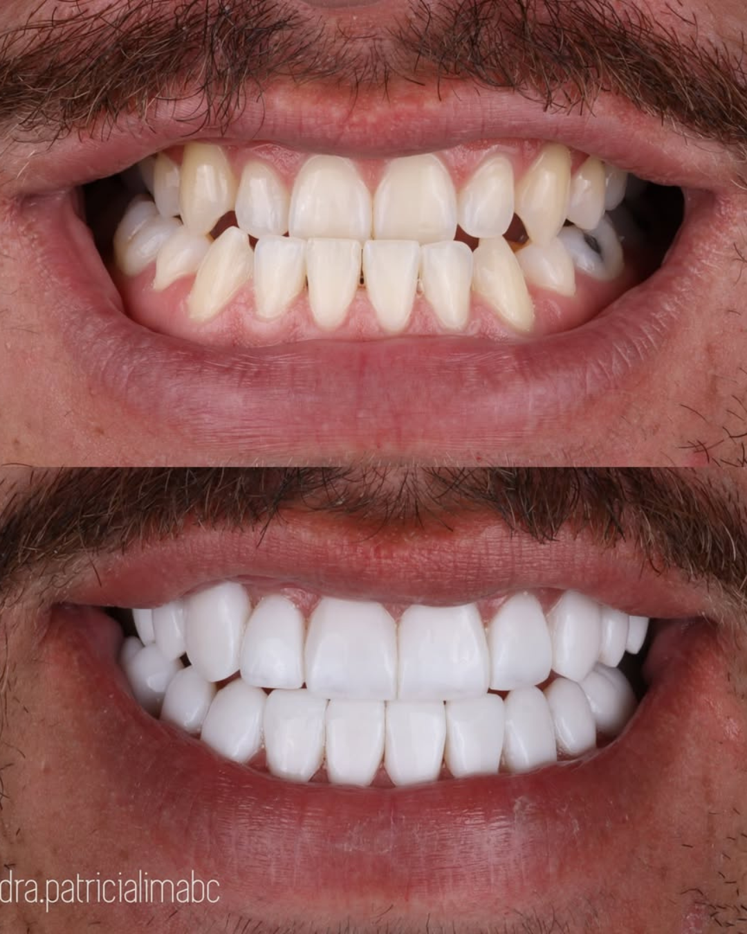 Antes e Depois 1